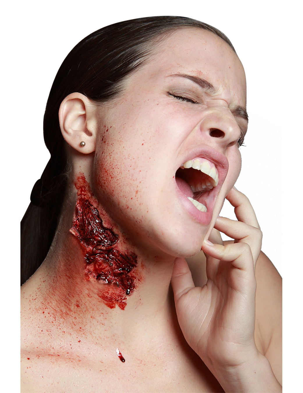 fausse-morsure-profonde_227142_1