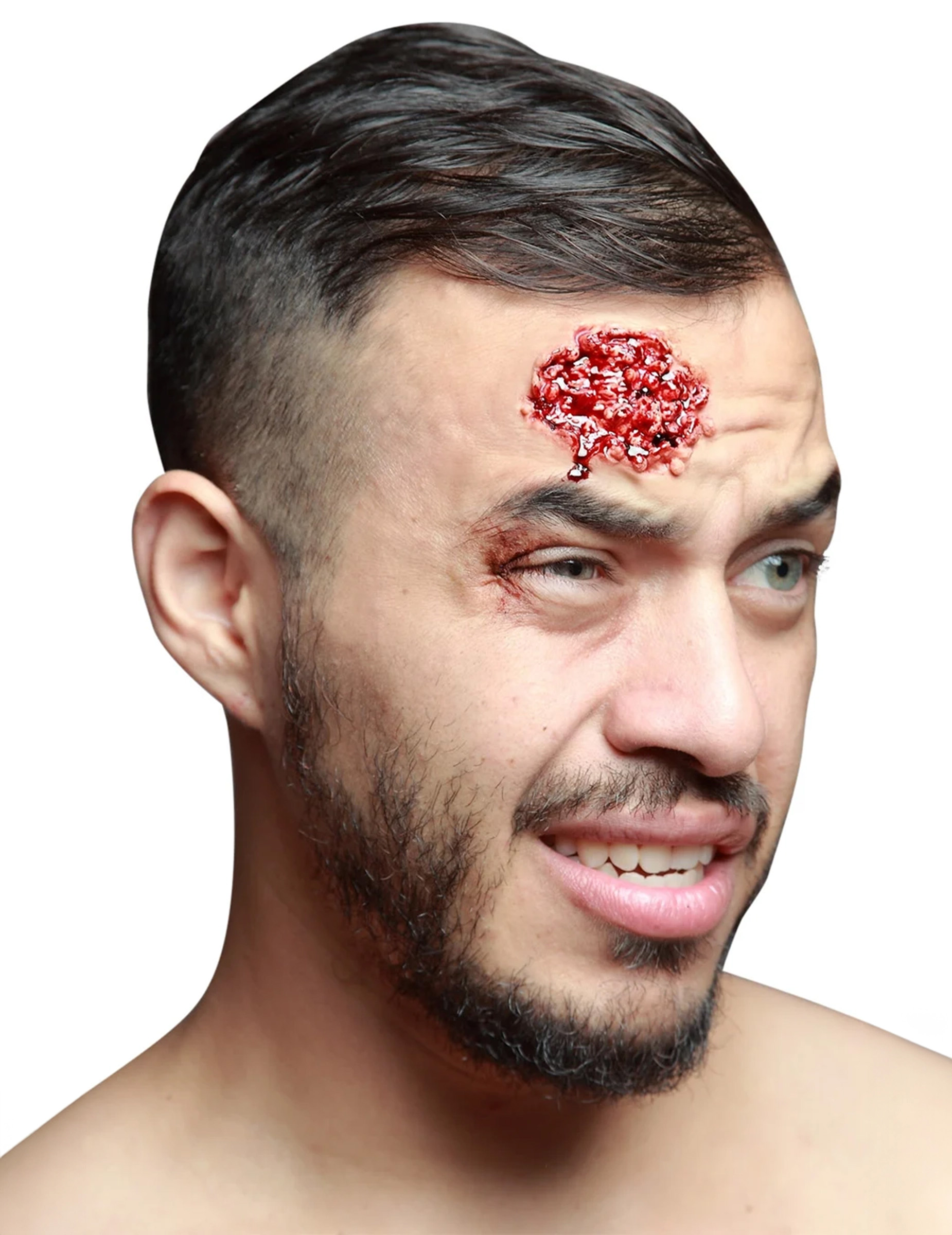 fausse-plaie-infectee_227014_2